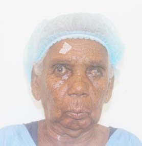 patient Image